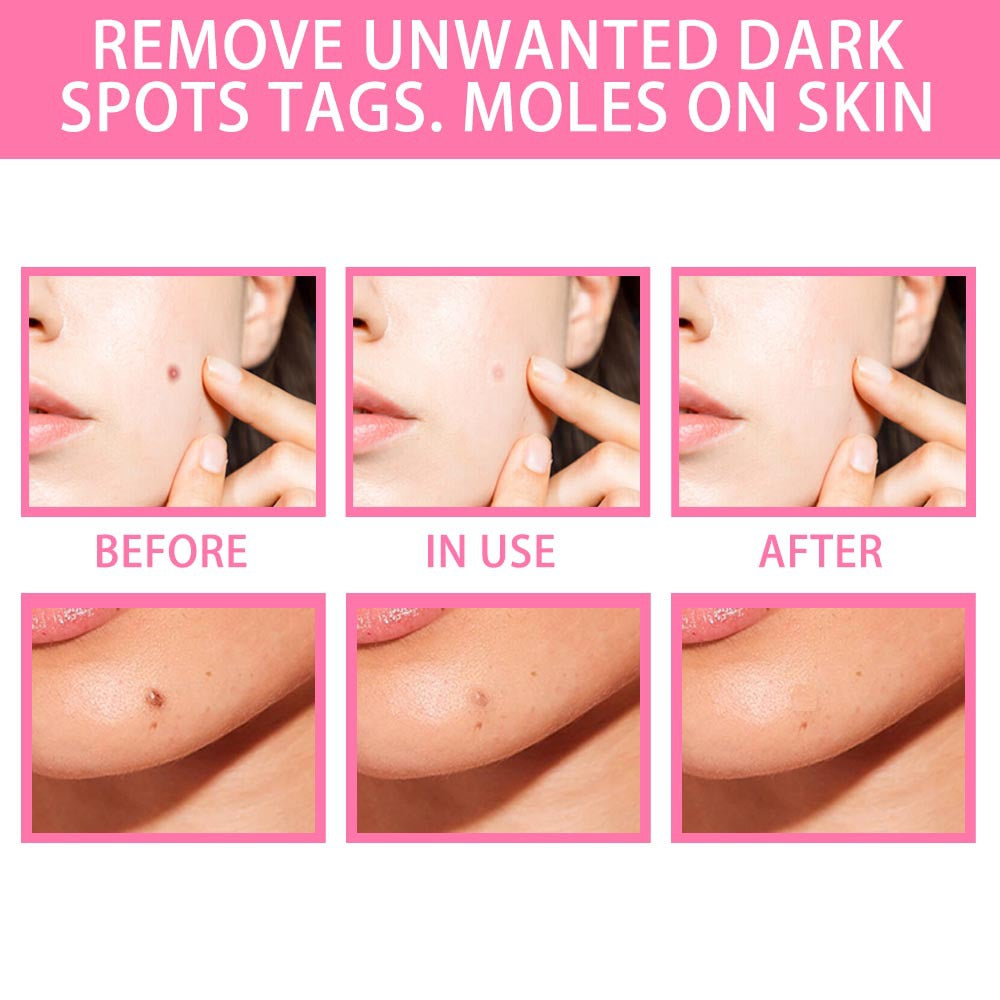 Skin Tag Remover Serum