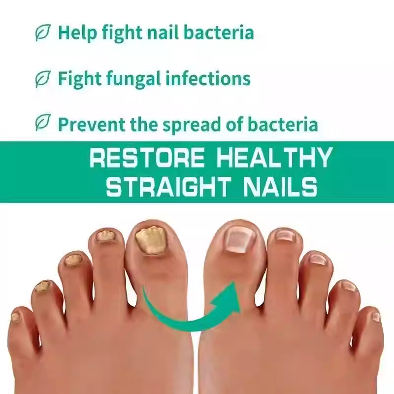 Nail Fungus Treatment Serum