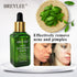 Acne Scar Removal Serum
