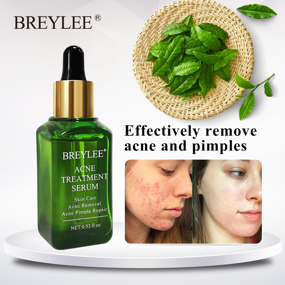 Acne Scar Removal Serum