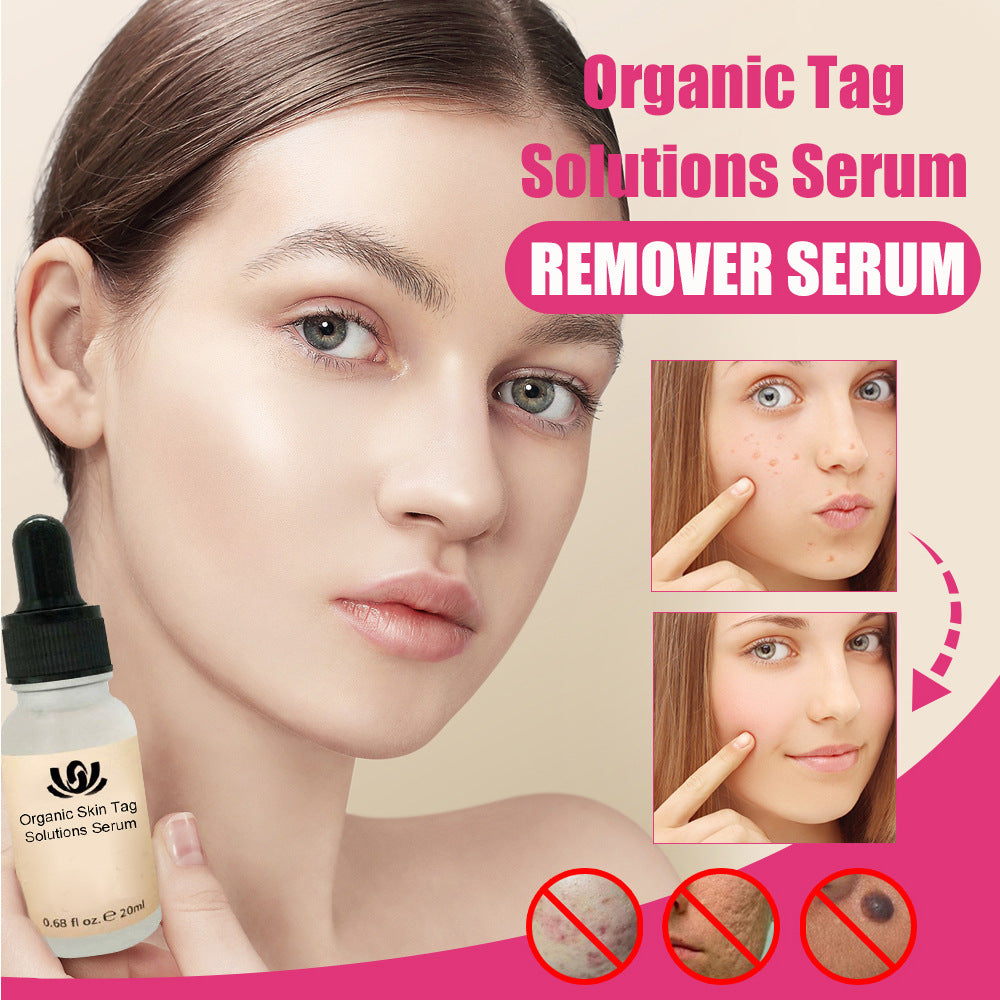 Skin Tag Remover Serum