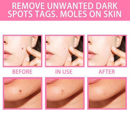 Skin Tag Remover Serum