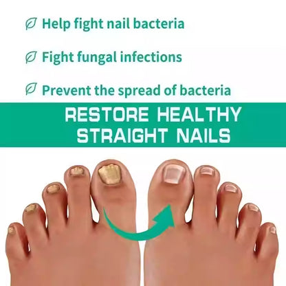 Nail Fungus Treatment Serum