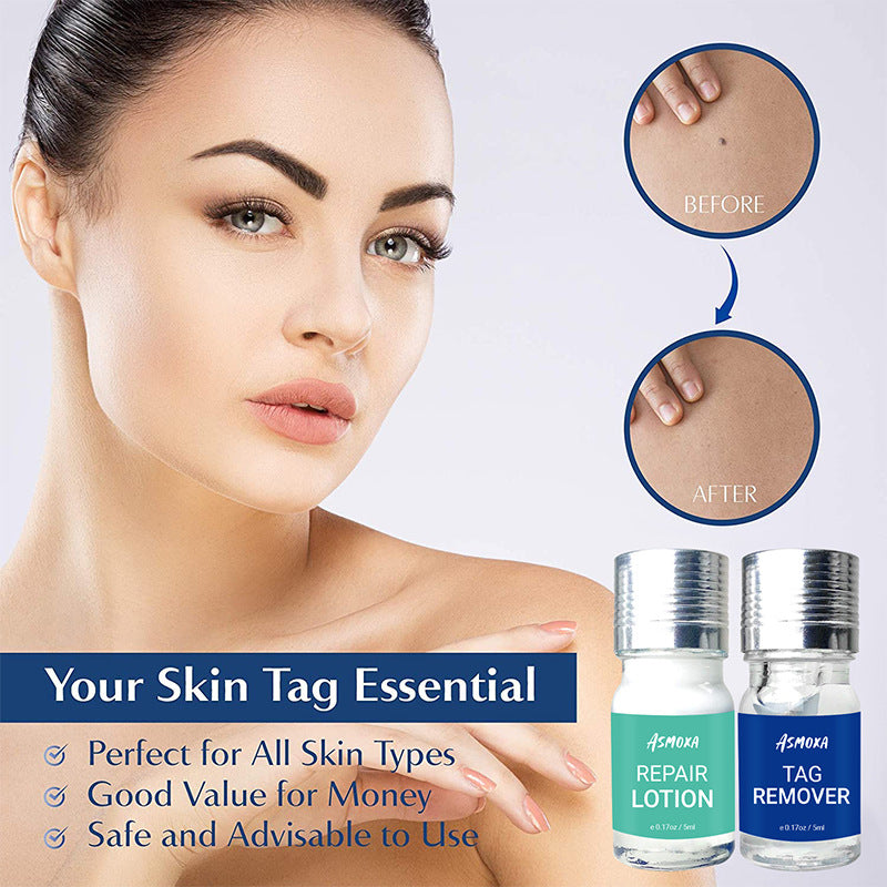 Mole Remover Cream